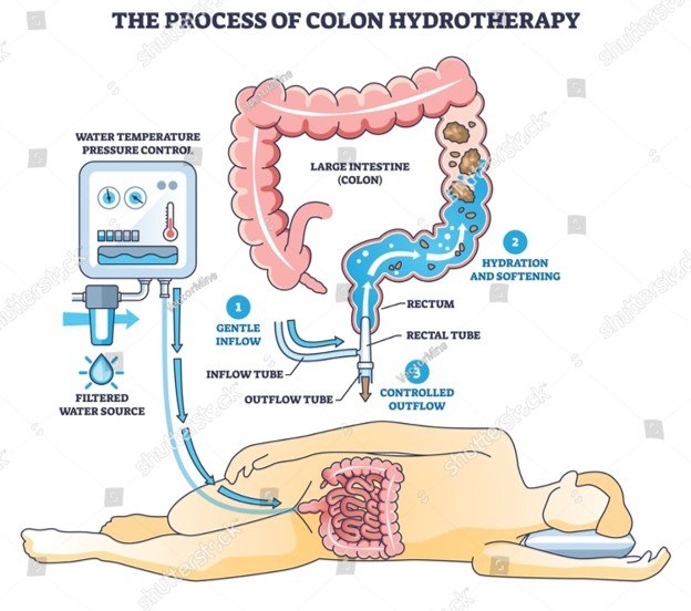 Colon Process