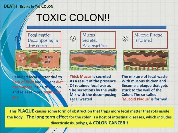 Toxic Colon